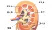 肾结石患者的饮食禁忌